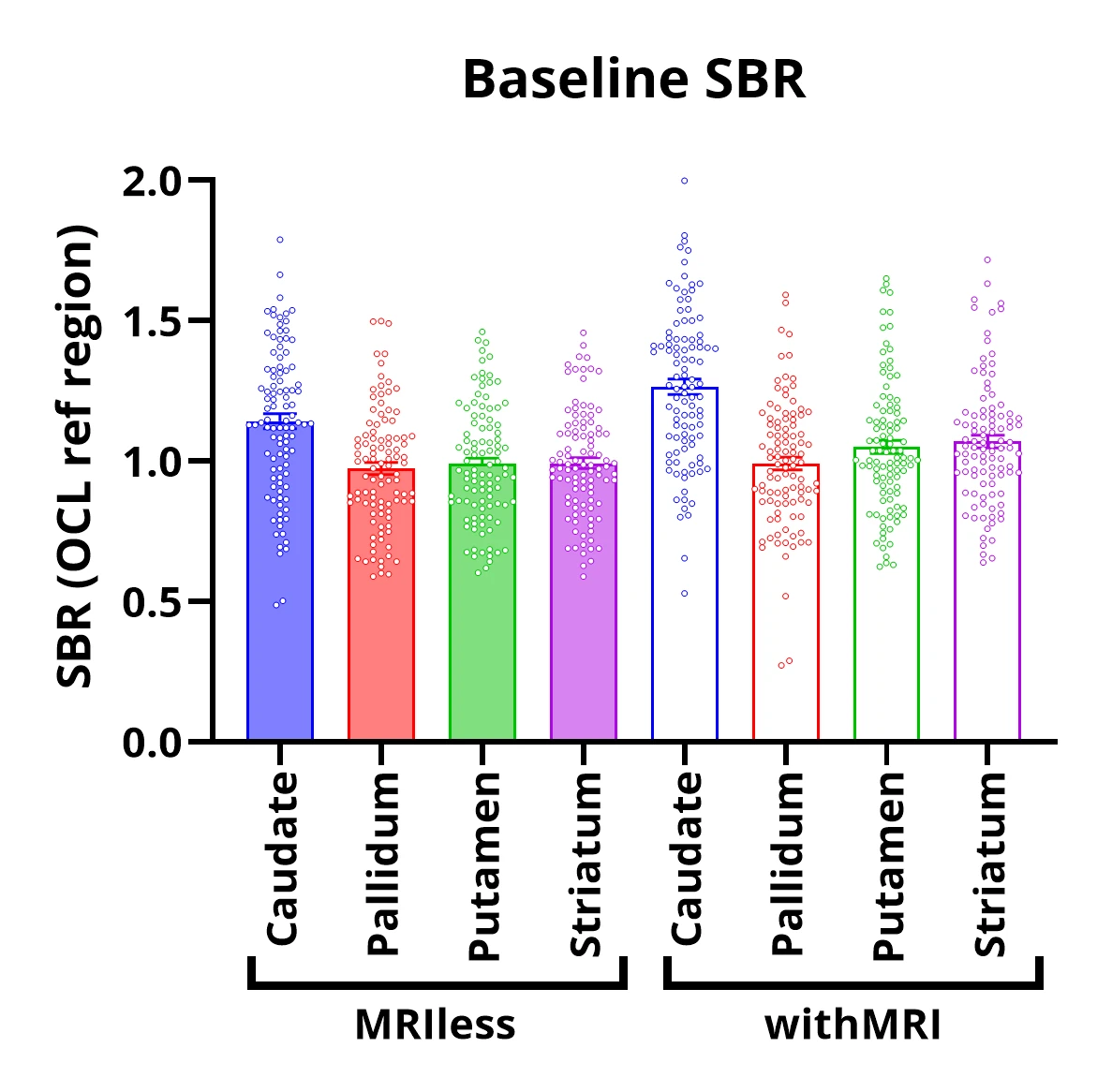 SBRのベースライングラフ