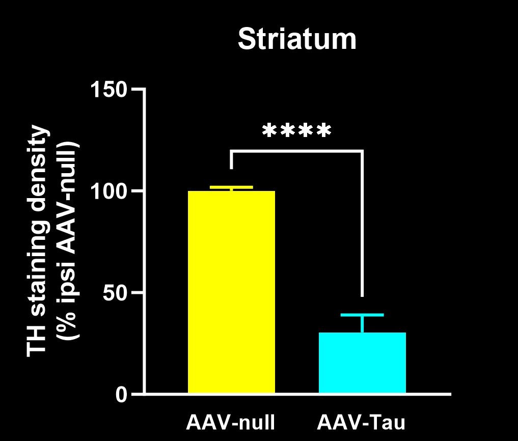 尾状突起中的酪氨酸羟化酶染色