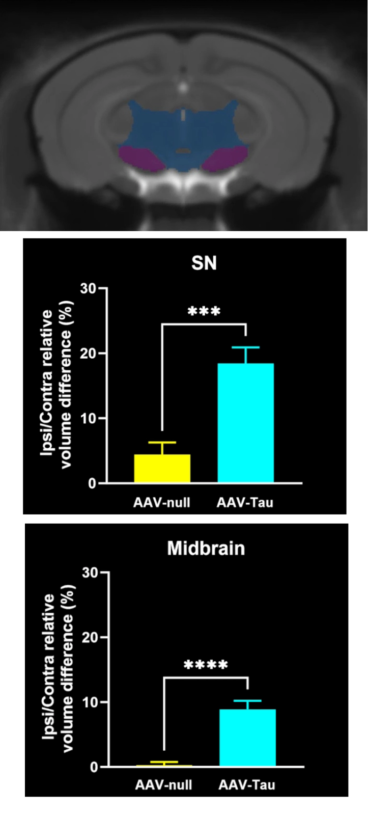 SNc 级核磁共振成像脑图谱和体积数据