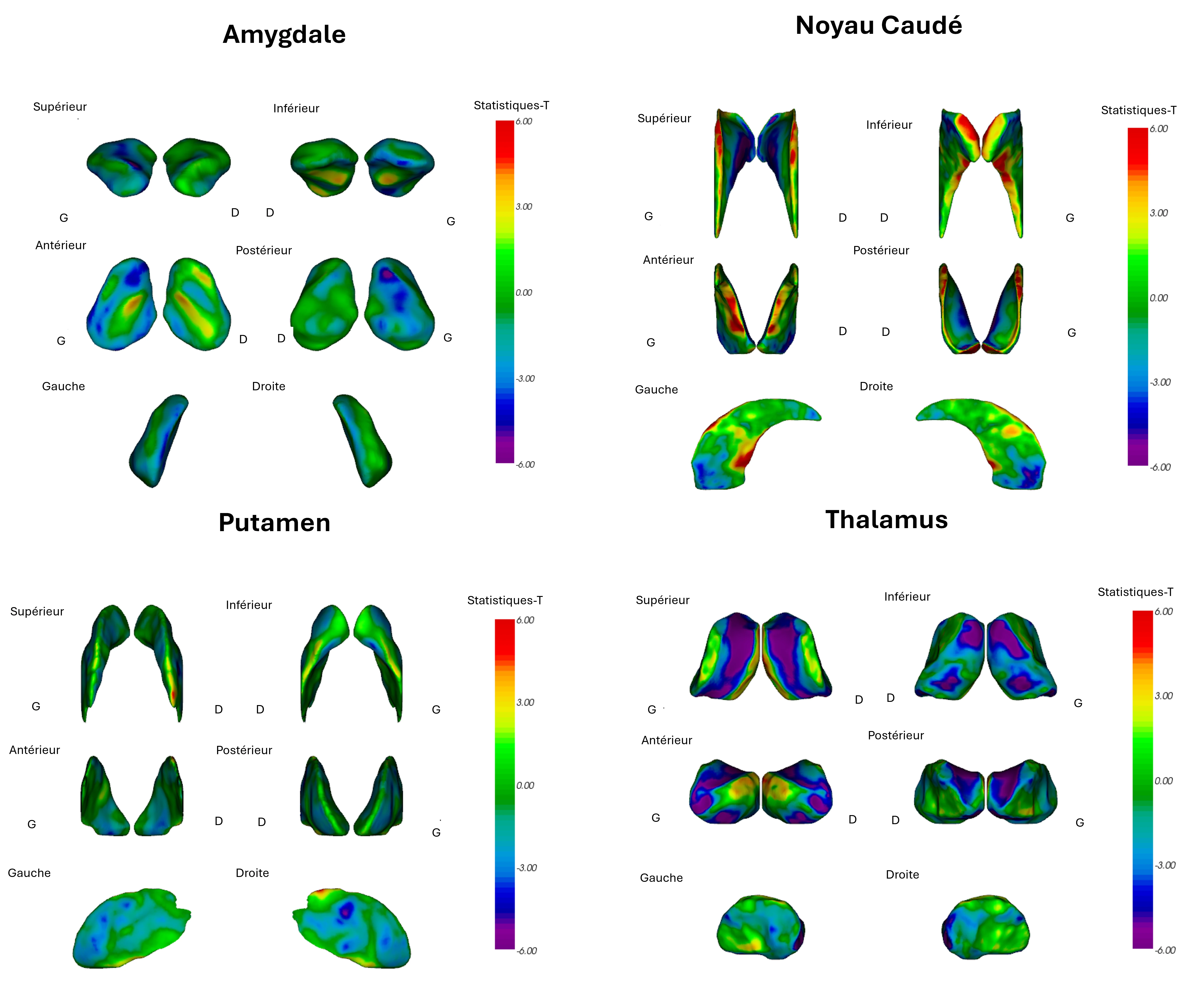Figure illustrant l'analyse longitudinale de plusieurs déformations de surface