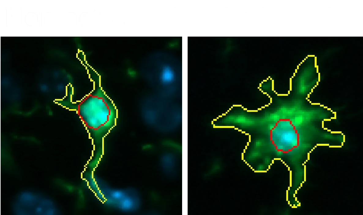 未激活和激活的小胶质细胞图像