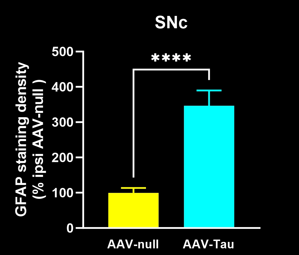 SNc 中 GFAP 染色密度图