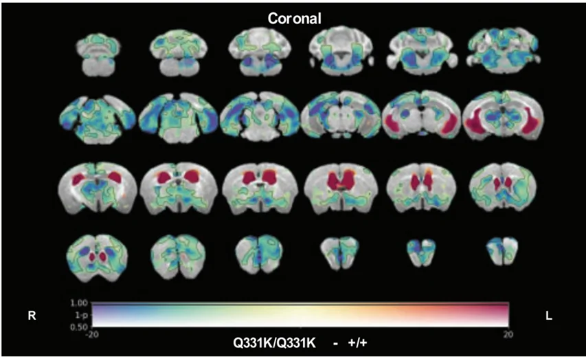 In vivo MRI results in TDP-43 FTD animal models