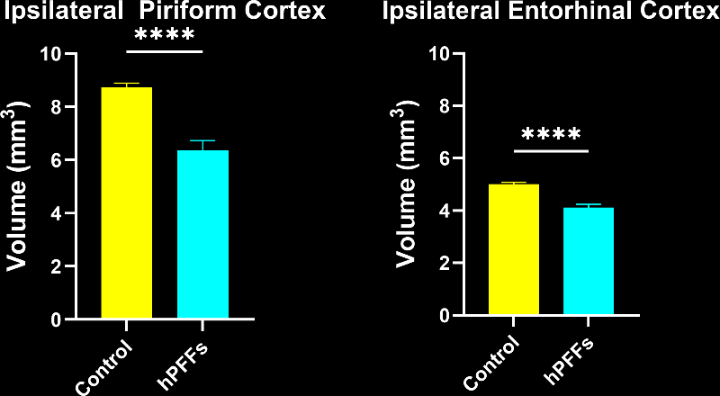 Graph showing a strong decrease in brain volume in piriform and entorhinal cortices of hPFFs injected animals
