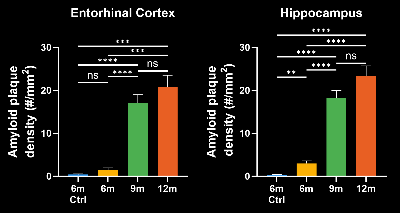 Comparison of Amyloid plaque density in entorhinal cortex and hippocampus region control (WT; 6 month) and ARTE 10 (6,9,12 month) old mice 