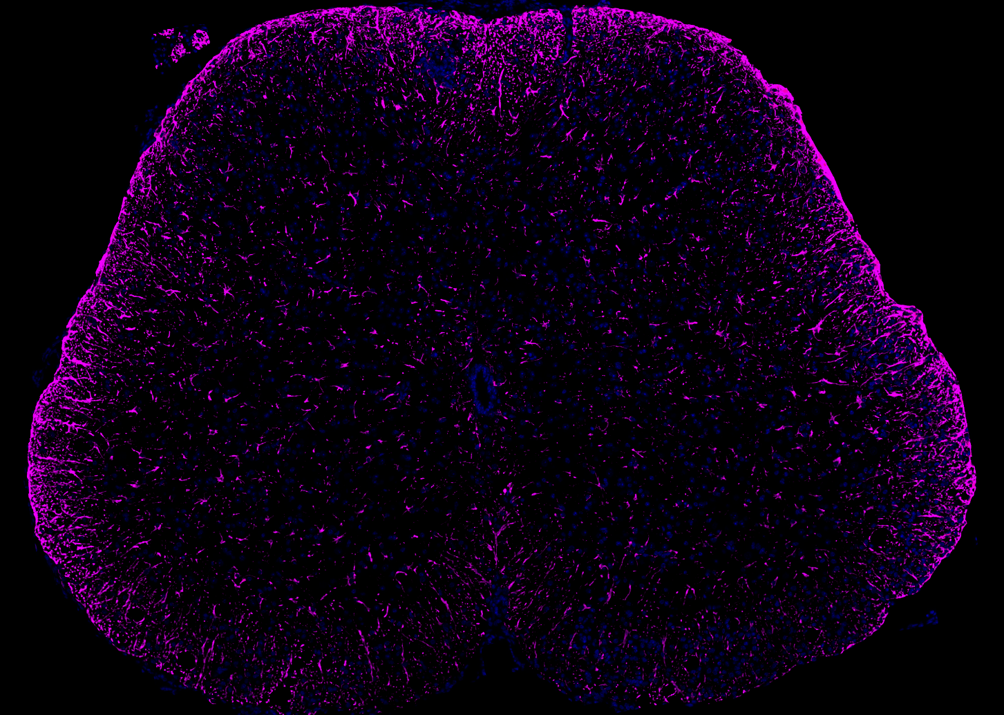 Astrocytes in EAE mouse model