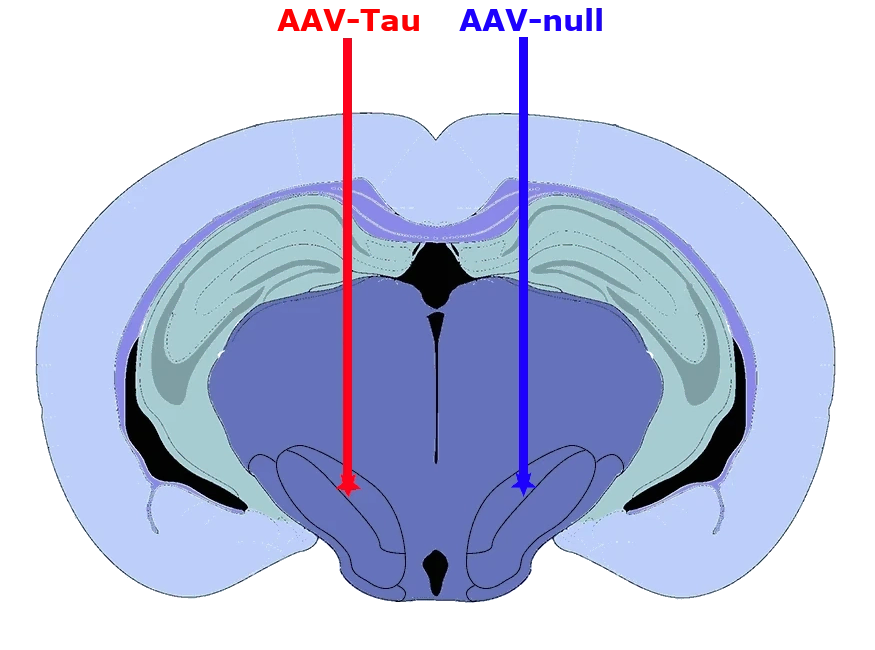 带有 AAV 注射部位的冠状图