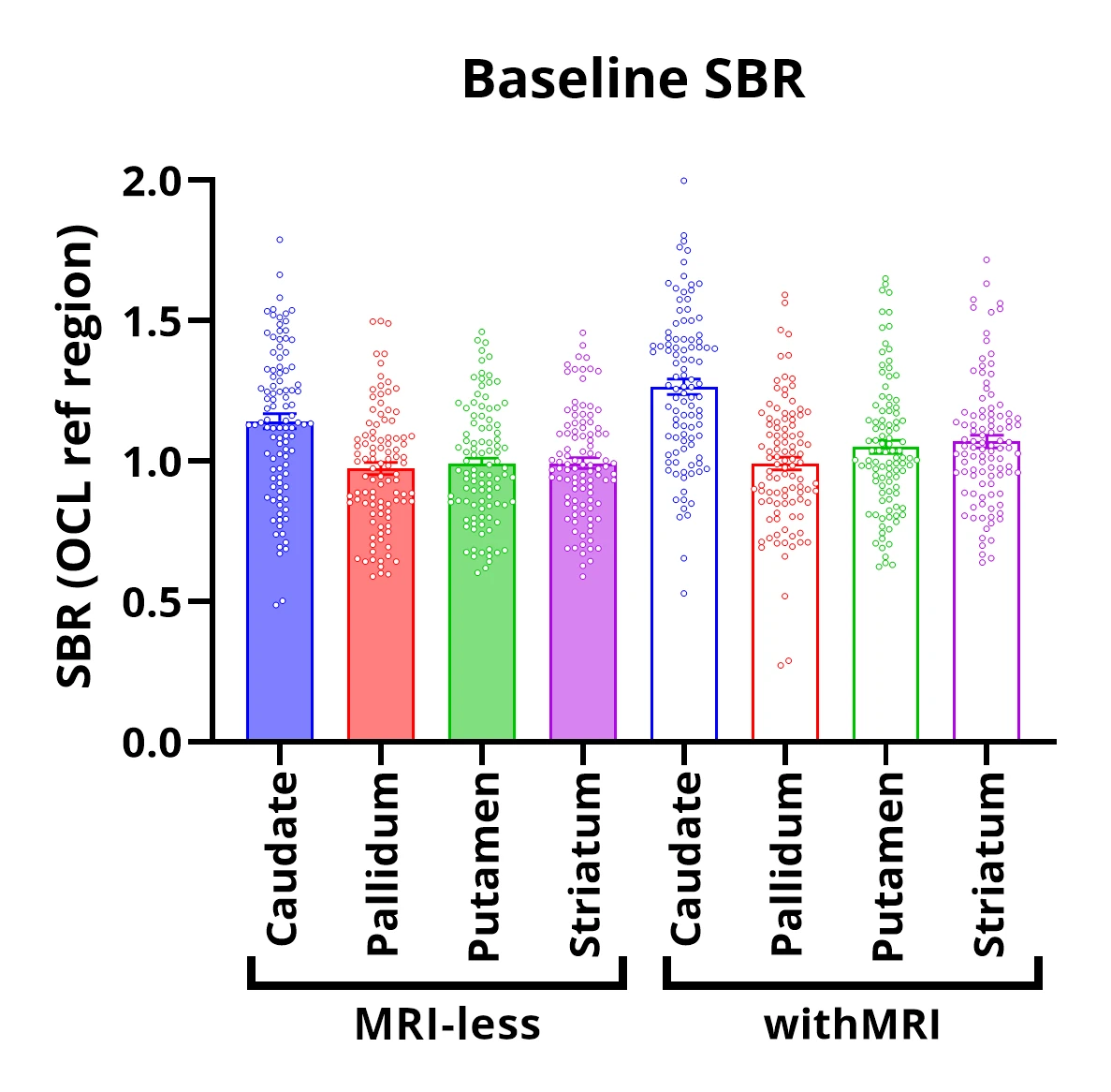 Baseline SBR graph