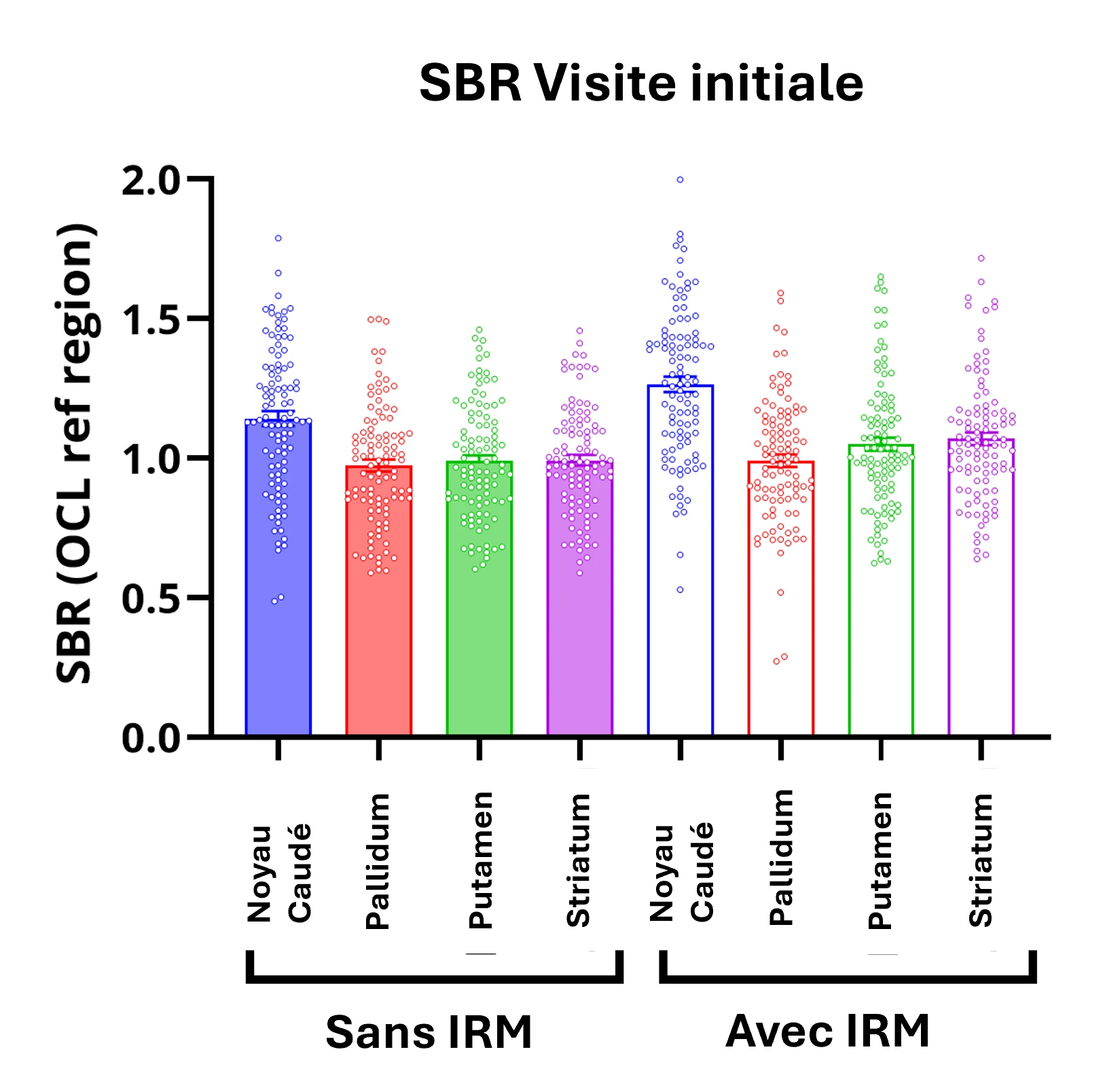 Graphique SBR de référence