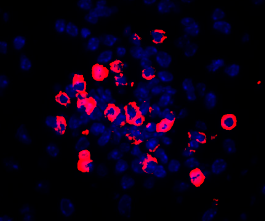 High magnification of T lymphocytes in EAE mouse model
