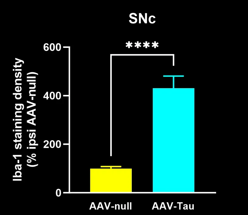 AAV-Null 和 AAV-Tau 注射小鼠的 Iba-1 染色图
