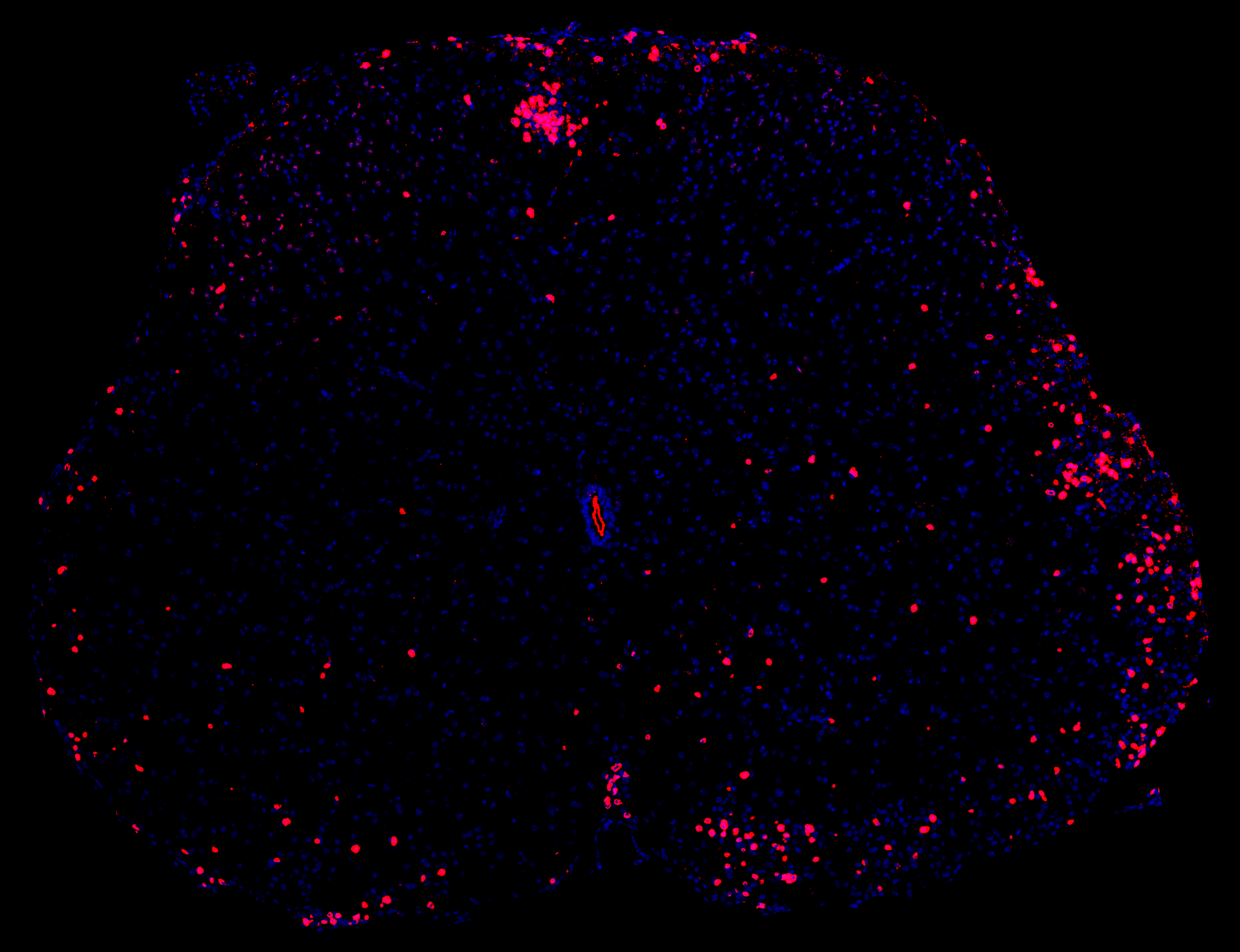 T lymphocytes in EAE mouse model