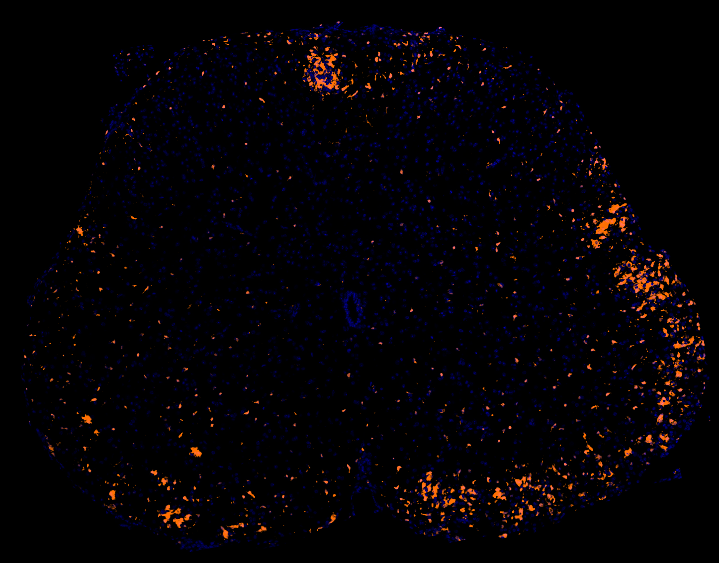 Macrophages/Microglia in EAE model