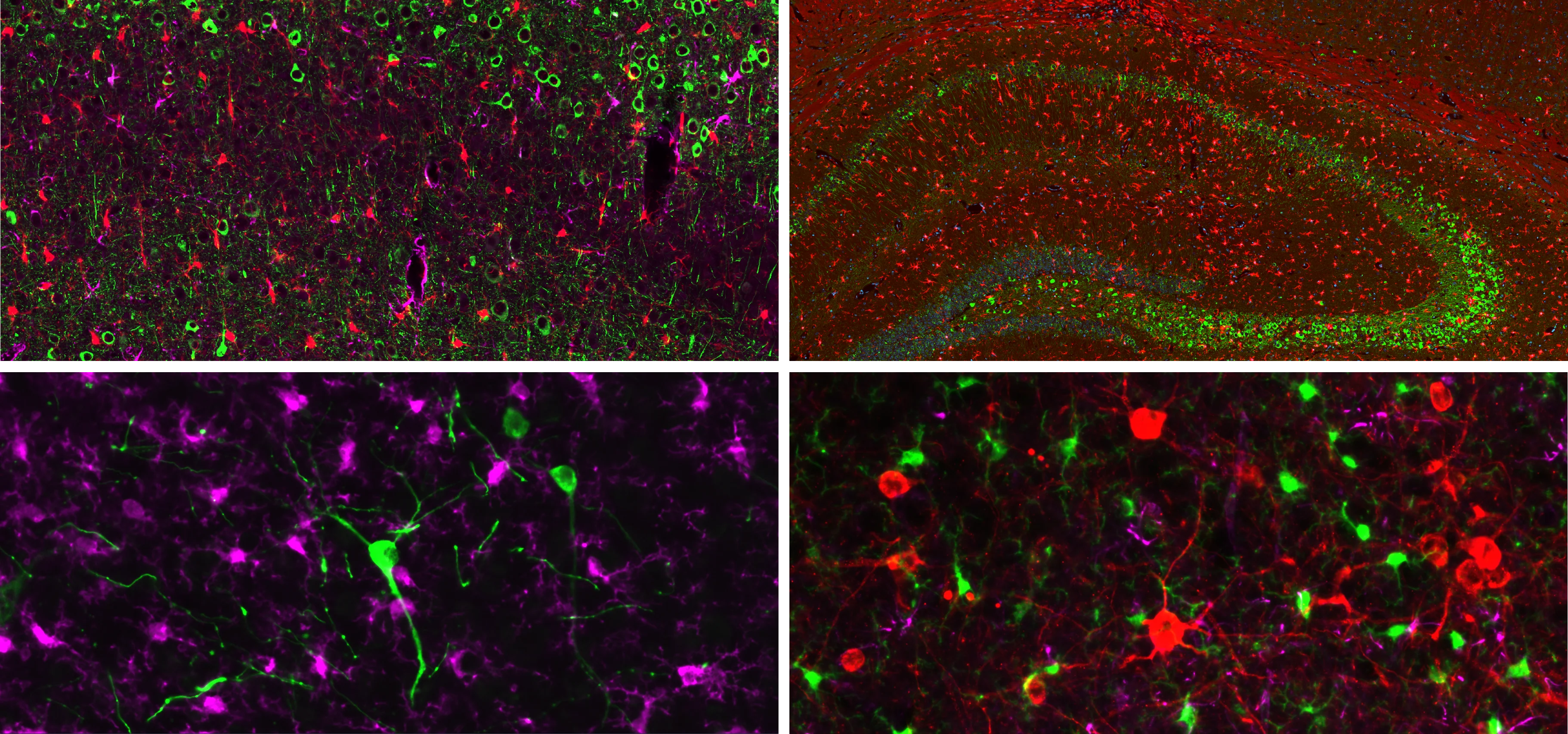 小鼠大脑 tau 染色的多重 IF